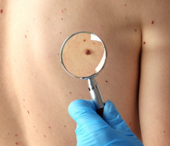 Dermatology Services